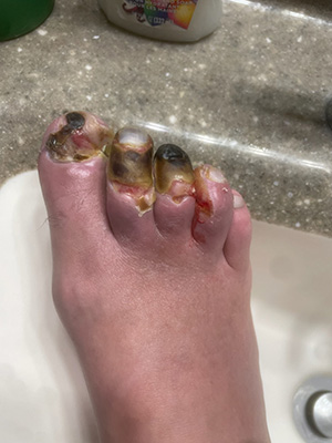 Chronic-Pain-Columbia-MO-Foot-Injury-Before